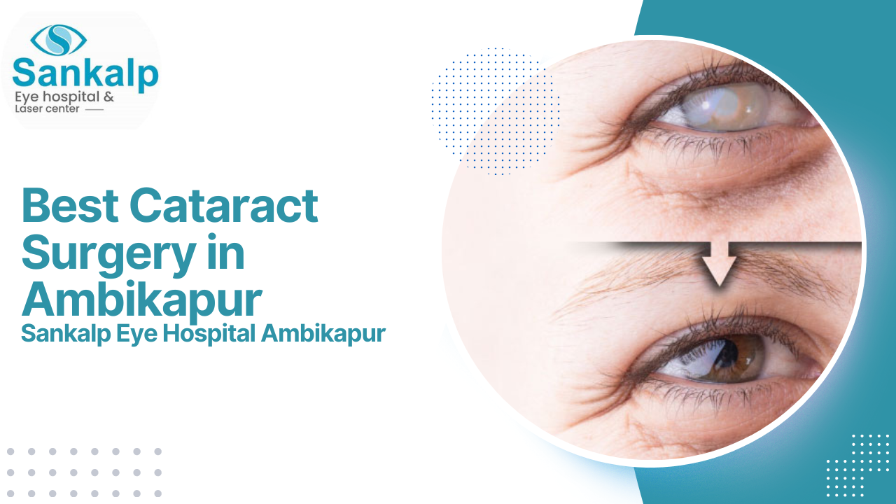 You are currently viewing Best Cataract Surgery in Ambikapur